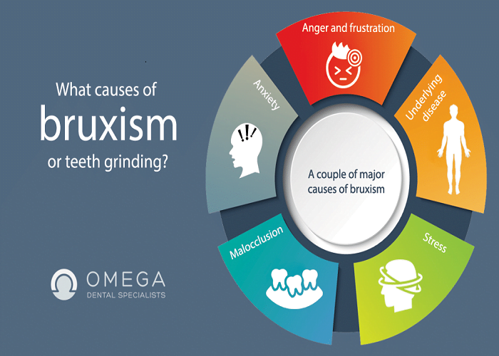 What Causes Bruxism?