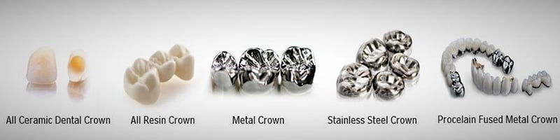 Different Types of Dental Crown