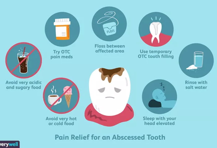 How tooth abscess pain relief before seeing the dentist