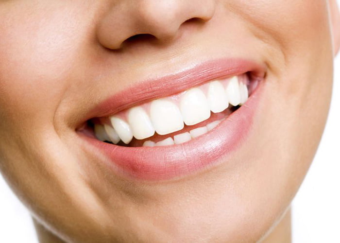 Sensitivity after Teeth Whitening