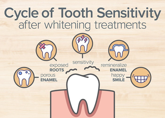 Why can Teeth Whitening Cause Sensitivity?