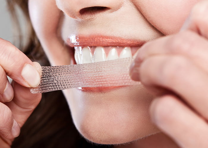 At-Home Teeth Whitening: How to Avoid Sensitivity