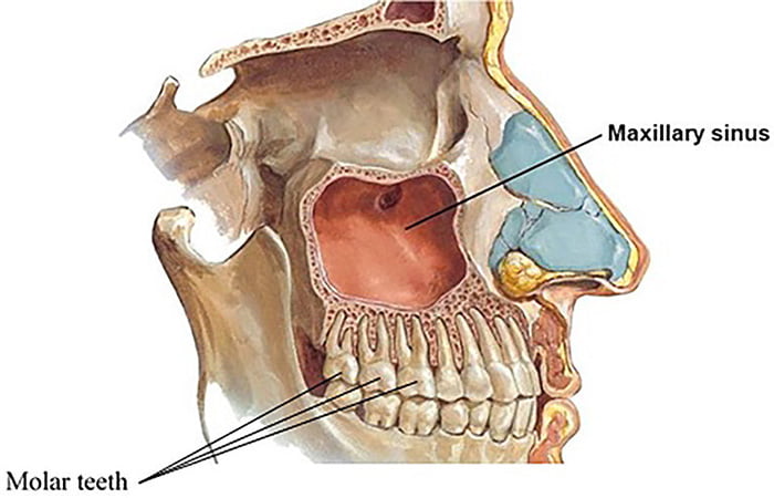 do cavities cause pain