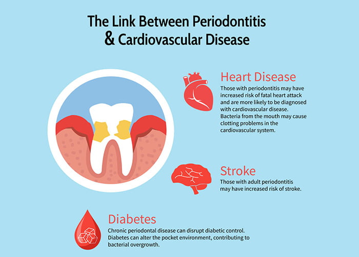 The Link Between Heart Health and Gum Disease 
