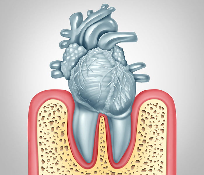 Taking Care of Your Gums