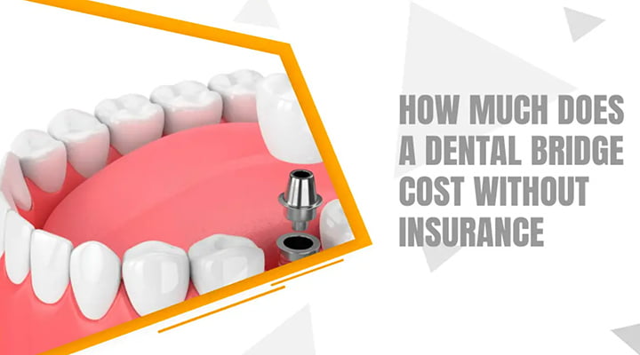 3 Ways To Finance Dental Work That Aren’t Insurance