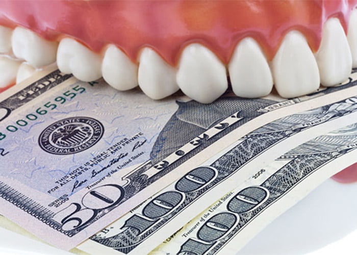 Dental fillings cost