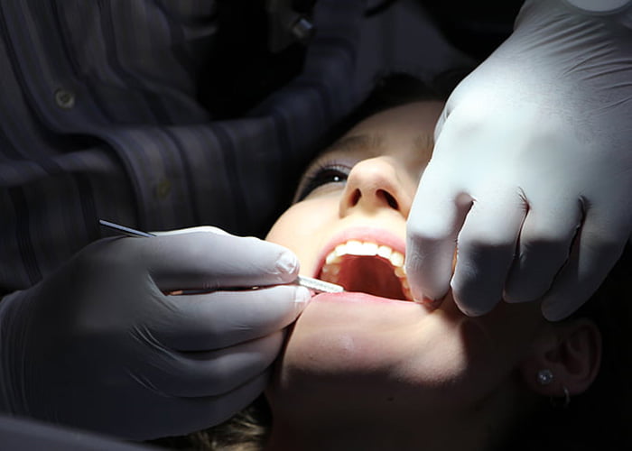 How Much Does a Tooth Extraction Cost Without Insurance?