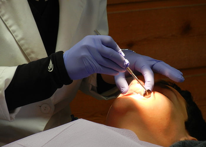 When Is Tooth Extraction Recommended?