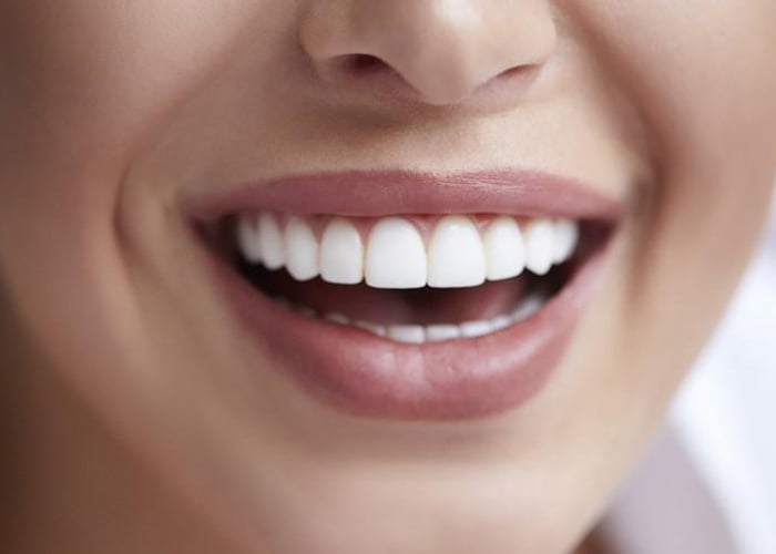 How Long Does It Take to Recover from Dental Implants?