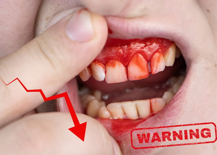 Decrease the risk of oral disease and inflammation