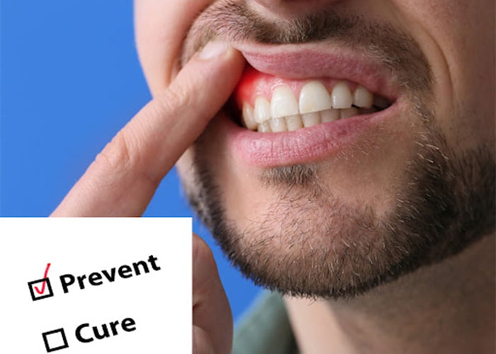 Prevent cysts, tumours, and jaw damage
