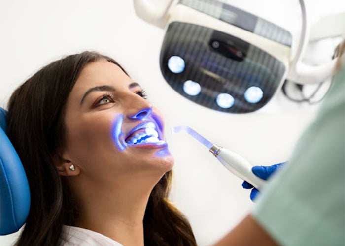 Teeth whitening procedure performed by a dentist or dental professional