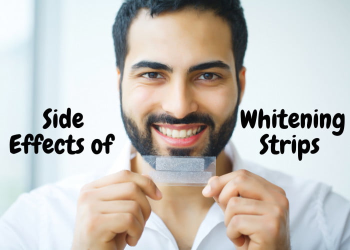 Side Effects of Whitening Strips