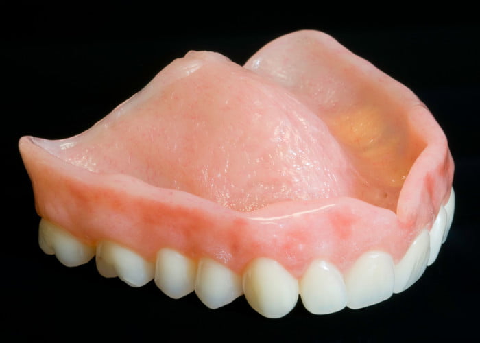 Disadvantages of Flexible Partial Dentures