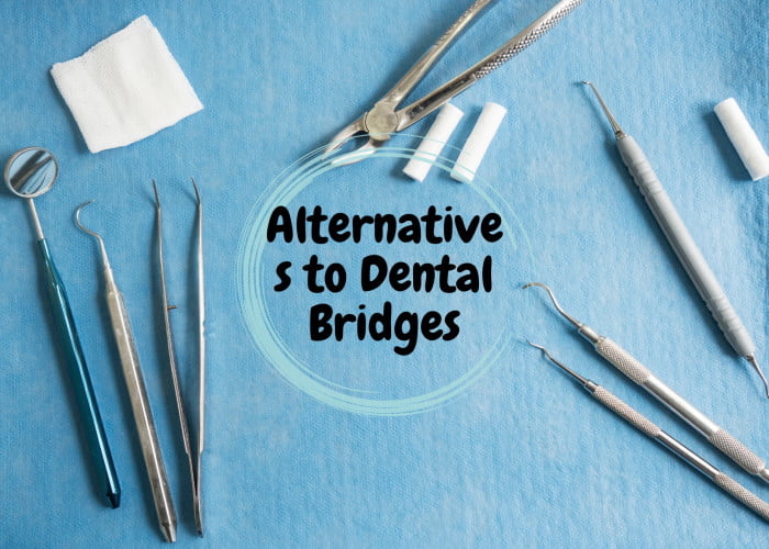 Alternatives to Dental Bridges