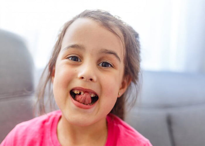 What to Expect During the Process of Losing Baby Teeth