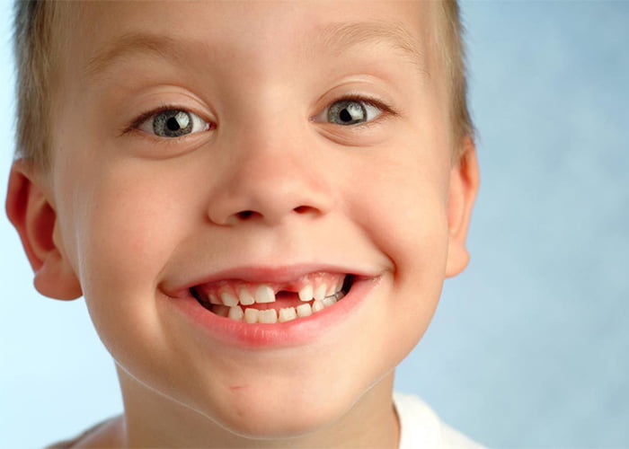When Do Kids Lose Teeth?